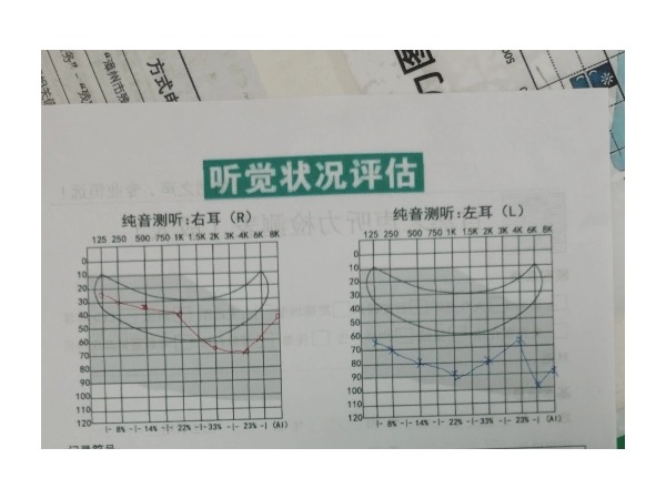64岁听障老人重获清晰世界： 一副助听器，十年困扰终化解！